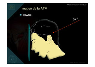Articulación temporo mandibular


Imagen de la ATM
Towne
                                         o
                               30




                       Derechos Reservados © 2008 por A. Padilla
 