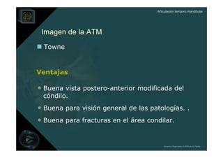Articulación temporo mandibular




 Imagen de la ATM
  Towne


Ventajas

• Buena vista postero-anterior modificada del
 cóndilo.
• Buena para visión general de las patologías. .
• Buena para fracturas en el área condilar.


                                         Derechos Reservados © 2008 por A. Padilla
 