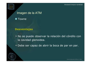 Articulación temporo mandibular




 Imagen de la ATM
  Towne


Desventajas

• No se puede observar la relación del cóndilo con
 la cavidad glenoidea.

• Debe ser capaz de abrir la boca de par en par.



                                         Derechos Reservados © 2008 por A. Padilla
 