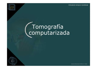 Articulación temporo mandibular




 Tomografía
computarizada




                Derechos Reservados © 2008 por A. Padilla
 