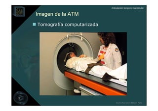 Articulación temporo mandibular


Imagen de la ATM
Tomografía computarizada




                               Derechos Reservados © 2008 por A. Padilla
 