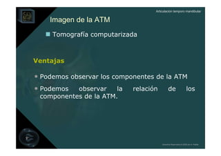 Articulación temporo mandibular


    Imagen de la ATM
     Tomografía computarizada



Ventajas

• Podemos observar los componentes de la ATM
• Podemos  observar    la   relación         de                   los
 componentes de la ATM.




                                       Derechos Reservados © 2008 por A. Padilla
 
