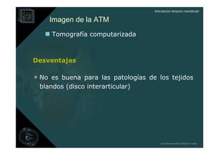 Articulación temporo mandibular


    Imagen de la ATM
     Tomografía computarizada



Desventajas

• No es buena para las patologías de los tejidos
 blandos (disco interarticular)




                                        Derechos Reservados © 2008 por A. Padilla
 