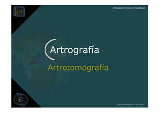 Articulación temporo mandibular




Artrografía
Artrotomografía



                      Derechos Reservados © 2008 por A. Padilla
 
