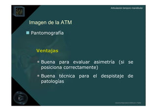Articulación temporo mandibular




Imagen de la ATM
Pantomografía


  Ventajas

  • Buena para evaluar asimetría (si se
    posiciona correctamente)
  • Buena técnica para el despistaje de
    patologías



                                   Derechos Reservados © 2008 por A. Padilla
 