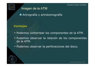 Articulación temporo mandibular


     Imagen de la ATM
      Artrografía y artrotomografía



Ventajas

• Podemos contornear los componentes de la ATM.
• Podemos observar la relación de los componentes
 de la ATM.
• Podemos observar la perforaciones del disco.



                                          Derechos Reservados © 2008 por A. Padilla
 
