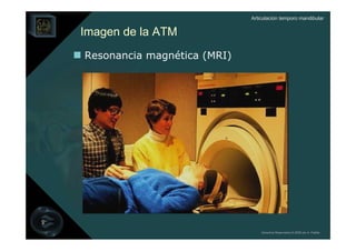 Articulación temporo mandibular


Imagen de la ATM
Resonancia magnética (MRI)




                                 Derechos Reservados © 2008 por A. Padilla
 