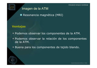 Articulación temporo mandibular


      Imagen de la ATM
       Resonancia magnética (MRI)



Ventajas

• Podemos observar los componentes de la ATM.
• Podemos observar la relación de los componentes
 de la ATM.
• Buena para los componentes de tejido blando.



                                          Derechos Reservados © 2008 por A. Padilla
 