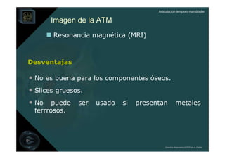 Articulación temporo mandibular


      Imagen de la ATM
       Resonancia magnética (MRI)



Desventajas

• No es buena para los componentes óseos.
• Slices gruesos.
• No puede ser usado si presentan metales
 ferrrosos.




                                         Derechos Reservados © 2008 por A. Padilla
 