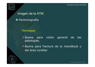 Articulación temporo mandibular




Imagen de la ATM
Pantomografía


  Ventajas

  • Buena    para   visión   general     de                las
    patologías.

  • Buena para fractura de la mandíbula y
    del área condilar



                                       Derechos Reservados © 2008 por A. Padilla
 