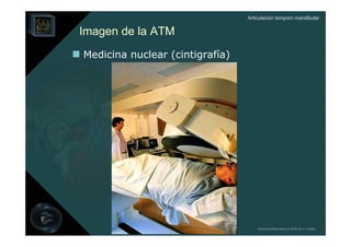 Articulación temporo mandibular


Imagen de la ATM
Medicina nuclear (cintigrafía)




                                     Derechos Reservados © 2008 por A. Padilla
 