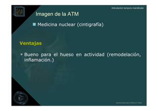 Articulación temporo mandibular


      Imagen de la ATM
       Medicina nuclear (cintigrafía)



Ventajas

• Bueno para el hueso en actividad (remodelación,
 inflamación.)




                                            Derechos Reservados © 2008 por A. Padilla
 