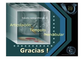 Estudio radiográfico de la


Articulación
           Temporo
                 mandibular



     Gracias !                    Derechos Reservados © 2008 por A. Padilla
 