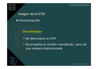 Articulación temporo mandibular




Imagen de la ATM
Pantomografía


  Desventajas

  • No demuestra la ATM
  • Se presenta el cóndilo mandibular, pero de
    una manera distorsionada




                                      Derechos Reservados © 2008 por A. Padilla
 