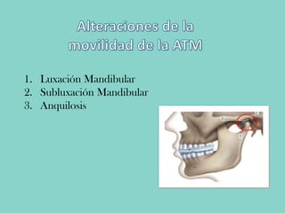 1. Luxación Mandibular
2. Subluxación Mandibular
3. Anquilosis
 