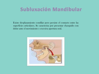 Existe desplazamiento condilar pero persiste el contacto entre las
superficies articulares. Se caracteriza por presentar chasquido con
dolor ante el movimiento y excesiva apertura oral.
 