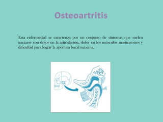 Esta enfermedad se caracteriza por un conjunto de síntomas que suelen
iniciarse con dolor en la articulación, dolor en los músculos masticatorios y
dificultad para lograr la apertura bucal máxima.
 