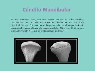 Es una eminencia ósea, con una cabeza convexa en todos sentidos,
especialmente en sentido anteroposterior, formando una estructura
elipsoidal. Su superficie superior es la que articula con el temporal. Su eje
longitudinal es perpendicular a la rama mandibular. Mide unos 15-20 mm en
sentido trasversal y 8-10 mm en sentido antero-posterior
 