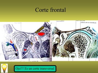 Corte frontal
Ojo!!! Es un corte transversal
 