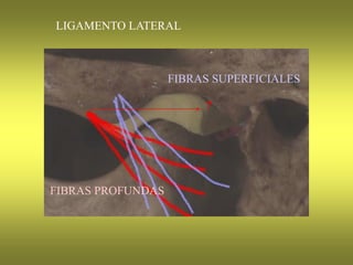 LIGAMENTO LATERAL
FIBRAS SUPERFICIALES
FIBRAS PROFUNDAS
?
 