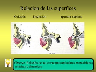 Relacion de las superfices
Oclusión inoclusión apertura máxima
Observe :Relación de las estructuras articulares en posiciones
estáticas y dinámicas
 