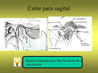 Corte para sagital
Realice esquemas para fijar las partes de la
articulación
 