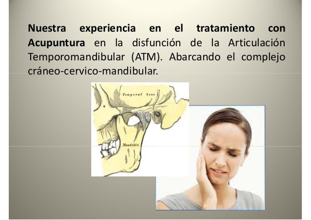 Nuestra experiencia en el tratamiento con
Acupuntura en la disfunción de la Articulación
Temporomandibular (ATM). Abarcand...