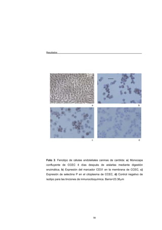 Resultados




Foto 3. Fenotipo de células endoteliales caninas de carótida: a) Monocapa
confluyente de CCEC 4 días después de aislarlas mediante digestión
enzimática, b) Expresión del marcador CD31 en la membrana de CCEC, c)
Expresión de selectina P en el citoplasma de CCEC, d) Control negativo de
isotipo para las tinciones de inmunocitoquímica. Barra=23.36µm




                                     56
 