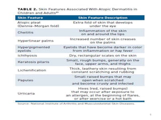 Atophic dermatitis Dr RAVINDRA G O | PPTX