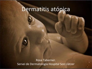 Dermatitis atópica




             Rosa Taberner.
Servei de Dermatología Hospital Son Llàtzer
 