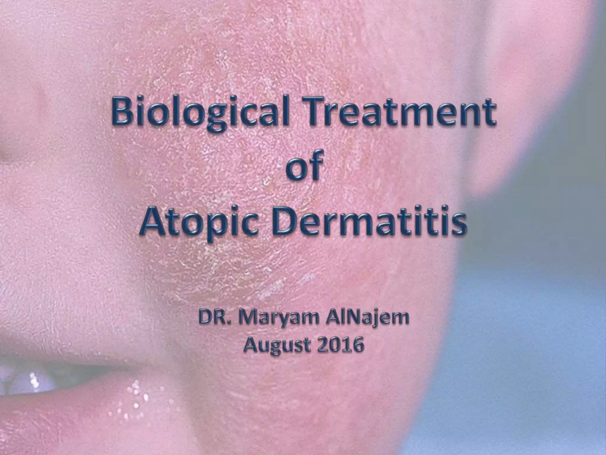 Biological Treatment of Atopic Dermatitis | PPTX