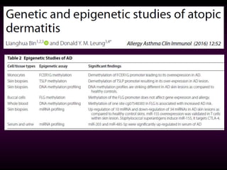 Atopic dermatitis | PPT