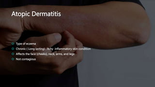 Atopic Dermatitis
 Type of eczema
 Chronic ( Long lasting) , itchy inflammatory skin condition
 Affects the face (cheeks), neck, arms, and legs
 Not contagious
 