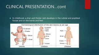 CLINICAL PRESENTATION…cont
 In childhood, a drier and thicker rash develops in the cubital and popliteal
fossae and on the hands and feet.
 