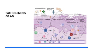 OVERVIEW OF ATOPIC DERMATITIS IN PEDIATRICS.pptx