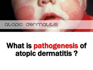 What is pathogenesis of
atopic dermatitis ?
 