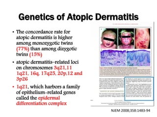 Genetics of Atopic Dermatitis
• The concordance rate for
atopic dermatitis is higher
among monozygotic twins
(77%) than among dizygotic
twins (15%)
• atopic dermatitis–related loci
on chromosomes 3q21,11
1q21, 16q, 17q25, 20p,12 and
3p26
• 1q21, which harbors a family
of epithelium-related genes
called the epidermal
differentiation complex
NJEM 2008;358:1483-94
 