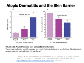 Atopic Dermatitis and the Skin Barrier
Patients with Atopic Dermatitis have Impaired Barrier Function
Transepidermal water loss (A) increase not only in lesional, but also in non-lesional skin of patients
normal controls, and hydration (B) is reduced.1
1. Aberg KM, et al. J Invest Dermatol 2008;128;917-925. 2. Jensen JM, et al. J Invest Dermatol
2004;122:1423-1431. 3. Chamlin SL, et al. J Am Acad Dermatol 2002;47:198-208 ที่มา:
http://www.epiceram.ca/physician/ad_skin_barrier.php 10/03/2015
 