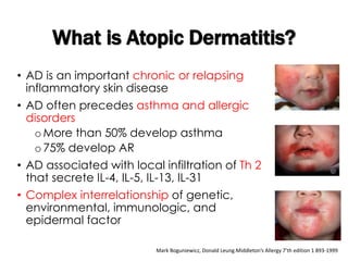 • AD is an important chronic or relapsing
inflammatory skin disease
• AD often precedes asthma and allergic
disorders
o More than 50% develop asthma
o 75% develop AR
• AD associated with local infiltration of Th 2
that secrete IL-4, IL-5, IL-13, IL-31
• Complex interrelationship of genetic,
environmental, immunologic, and
epidermal factor
What is Atopic Dermatitis?
Mark Boguniewicz, Donald Leung.Middleton’s Allergy 7’th edition 1 893-1999
 