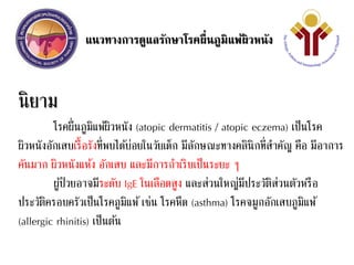แนวทางการดูแลรักษาโรคผื่นภูมิแพ้ผิวหนัง
นิยาม
โรคผื่นภูมิแพ้ผิวหนัง (atopic dermatitis / atopic eczema) เป็นโรค
ผิวหนังอักเสบเรื้อรังที่พบได้บ่อยในวัยเด็ก มีลักษณะทางคลินิกที่สาคัญ คือ มีอาการ
คันมาก ผิวหนังแห้ง อักเสบ และมีการกาเริบเป็นระยะ ๆ
ผู้ป่วยอาจมีระดับ IgE ในเลือดสูง และส่วนใหญ่มีประวัติส่วนตัวหรือ
ประวัติครอบครัวเป็นโรคภูมิแพ้เช่น โรคหืด (asthma) โรคจมูกอักเสบภูมิแพ้
(allergic rhinitis) เป็นต้น
 