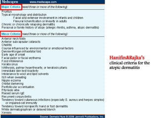 Hanifin&Rajka’s
clinical criteria for the
atopic dermatitis
 
