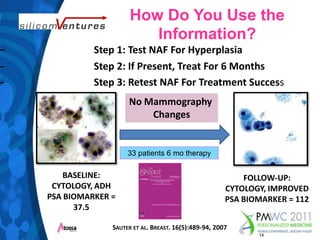 How Do You Use the Information?Step 1: Test NAF For Hyperplasia  			Step 2: If Present, Treat For 6 Months 			Step 3: Retest NAF For Treatment SuccessNo Mammography Changes33 patients 6 mo therapyBASELINE:CYTOLOGY, ADHPSA BIOMARKER = 37.5FOLLOW-UP:CYTOLOGY, IMPROVEDPSA BIOMARKER = 112Sauter et al. Breast.16(5):489-94, 200714