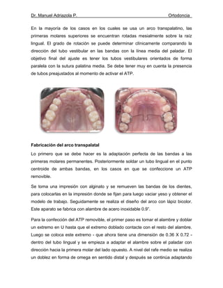 Dr. Manuel Adriazola P. Ortodoncia
En la mayoría de los casos en los cuales se usa un arco transpalatino, las
primeras molares superiores se encuentran rotadas mesialmente sobre la raíz
lingual. El grado de rotación se puede determinar clínicamente comparando la
dirección del tubo vestibular en las bandas con la línea media del paladar. El
objetivo final del ajuste es tener los tubos vestibulares orientados de forma
paralela con la sutura palatina media. Se debe tener muy en cuenta la presencia
de tubos preajustados al momento de activar el ATP.
Fabricación del arco transpalatal
Lo primero que se debe hacer es la adaptación perfecta de las bandas a las
primeras molares permanentes. Posteriormente soldar un tubo lingual en el punto
centroide de ambas bandas, en los casos en que se confeccione un ATP
removible.
Se toma una impresión con alginato y se remueven las bandas de los dientes,
para colocarlas en la impresión donde se fijan para luego vaciar yeso y obtener el
modelo de trabajo. Seguidamente se realiza el diseño del arco con lápiz bicolor.
Este aparato se fabrica con alambre de acero inoxidable 0.9”.
Para la confección del ATP removible, el primer paso es tomar el alambre y doblar
un extremo en U hasta que el extremo doblado contacte con el resto del alambre.
Luego se coloca este extremo - que ahora tiene una dimensión de 0.36 X 0.72 -
dentro del tubo lingual y se empieza a adaptar el alambre sobre el paladar con
dirección hacia la primera molar del lado opuesto. A nivel del rafe medio se realiza
un doblez en forma de omega en sentido distal y después se continúa adaptando
 