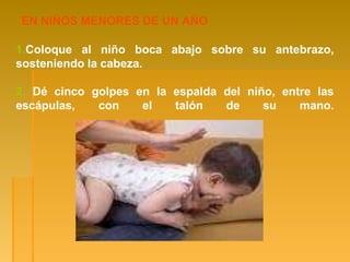 EN NIÑOS MENORES DE UN AÑO
sobre su antebrazo,
1.Coloque al niño boca abajo
sosteniendo la cabeza.
2. Dé cinco golpes en la espalda del niño, entre las
escápulas, con el talón de su mano.
 