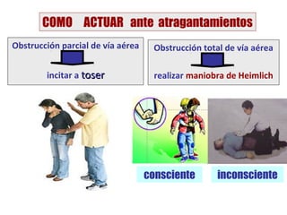COMO ACTUAR ante atragantamientos
Obstrucción parcial de vía aérea    Obstrucción total de vía aérea

        incitar a to...