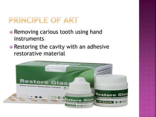  Removing carious tooth using hand
instruments
 Restoring the cavity with an adhesive
restorative material
 
