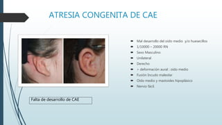 Atresia De Cae Modificado PPTX Atresia De Cae Modificado PPTX
