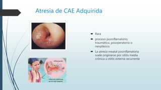 Atresia de CAE Adquirida
 Rara
 proceso posinflamatorio,
traumático, posoperatorio o
neoplásico.
 La atresia meatal posinflamatoria
suele originarse por otitis media
crónica u otitis externa recurrente
 