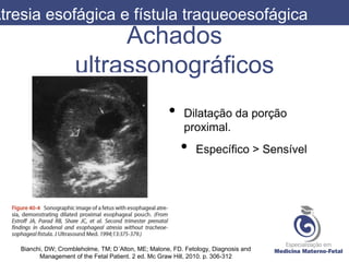 Achados
ultrassonográficos
Atresia esofágica e fístula traqueoesofágica
Bianchi, DW; Crombleholme, TM; D´Alton, ME; Malone, FD. Fetology, Diagnosis and
Management of the Fetal Patient. 2 ed. Mc Graw Hill, 2010. p. 306-312
• Dilatação da porção
proximal.
• Específico > Sensível
 