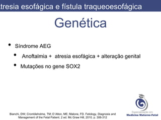 Genética
• Síndrome AEG
• Anoftalmia + atresia esofágica + alteração genital
• Mutações no gene SOX2
Atresia esofágica e fístula traqueoesofágica
Bianchi, DW; Crombleholme, TM; D´Alton, ME; Malone, FD. Fetology, Diagnosis and
Management of the Fetal Patient. 2 ed. Mc Graw Hill, 2010. p. 306-312
 